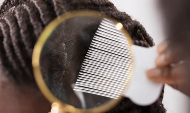 Comment se débarrasser facilement et éfficacement des poux ?