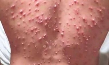 Confirmation écrite : les scientifiques ne peuvent apporter aucune preuve de l'existence d'un virus pathogène